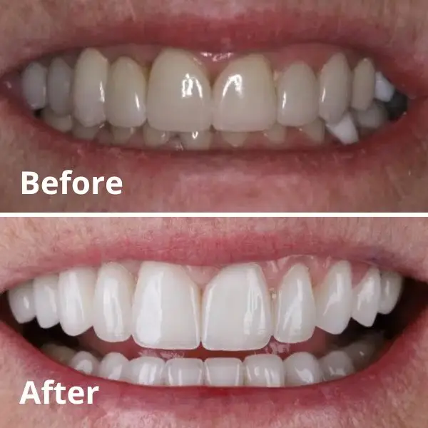 Modern Dentistry of Jupiter | Smile Gallery