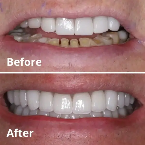 Modern Dentistry of Jupiter | Smile Gallery