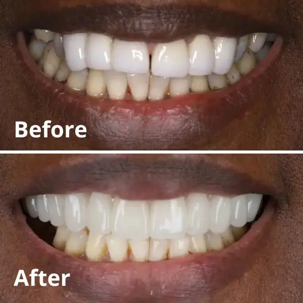 Modern Dentistry of Jupiter | Smile Gallery