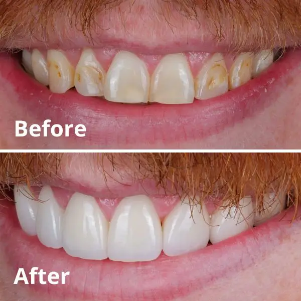 Modern Dentistry of Jupiter | Smile Gallery