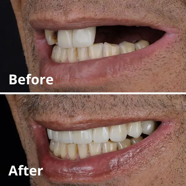 Modern Dentistry of Jupiter | Smile Gallery