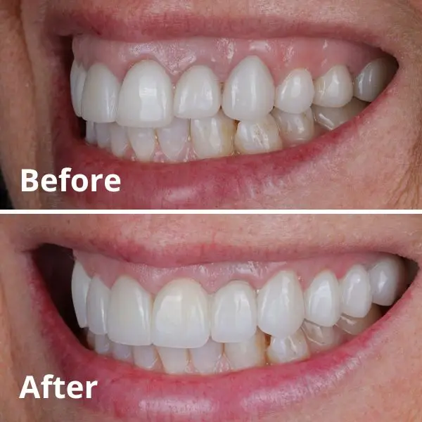 Modern Dentistry of Jupiter | Smile Gallery