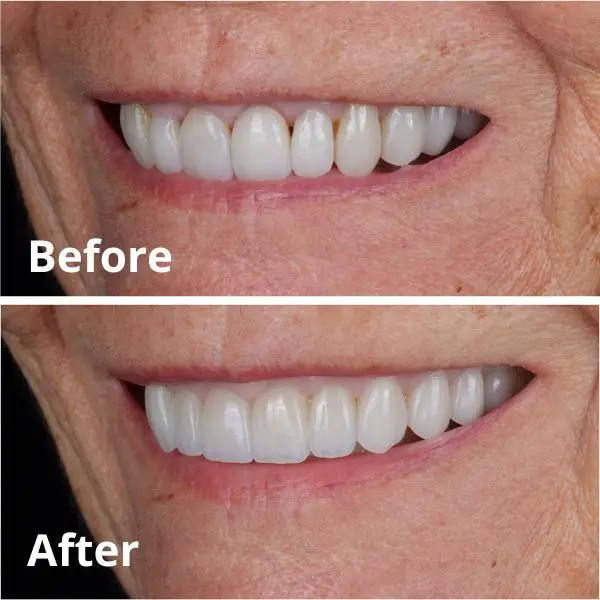 Modern Dentistry of Jupiter | Smile Gallery