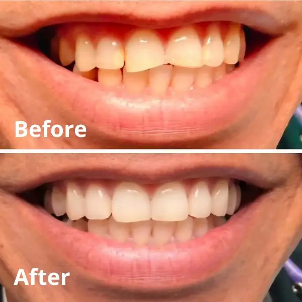 Modern Dentistry of Jupiter | Smile Gallery