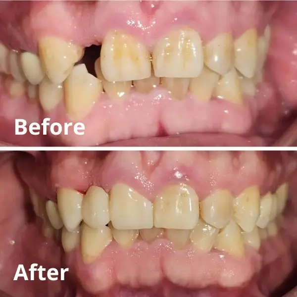 Modern Dentistry of Jupiter | Smile Gallery