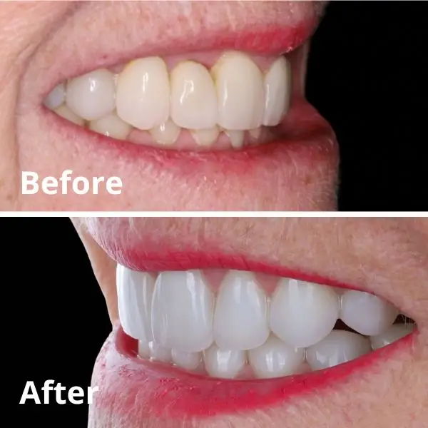 Modern Dentistry of Jupiter | Smile Gallery