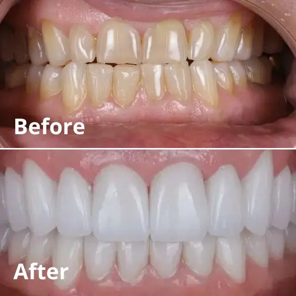 Modern Dentistry of Jupiter | Home
