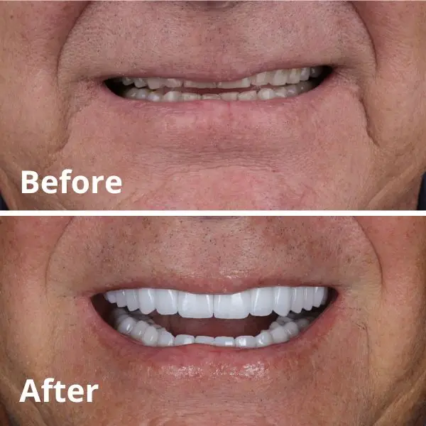 Modern Dentistry of Jupiter | Smile Gallery