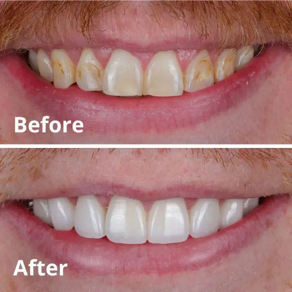 Modern Dentistry of Jupiter | Smile Gallery