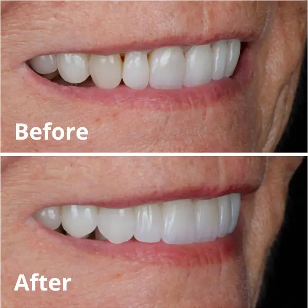 Modern Dentistry of Jupiter | Smile Gallery