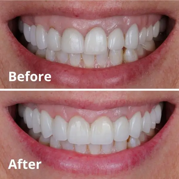 Modern Dentistry of Jupiter | Smile Gallery