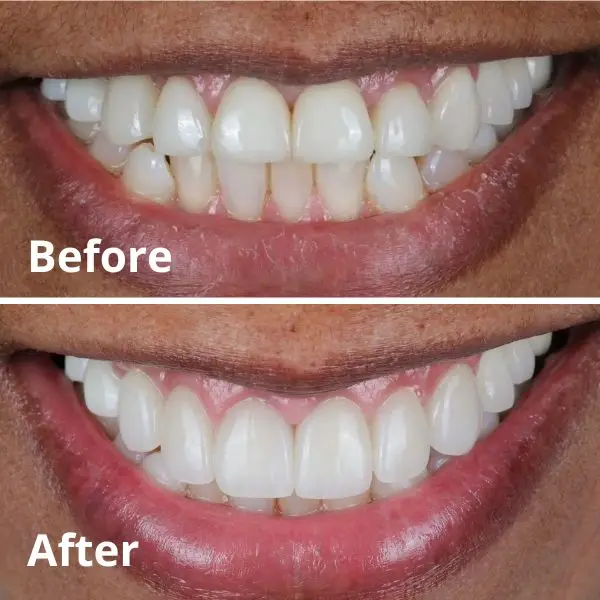 Modern Dentistry of Jupiter | Smile Gallery