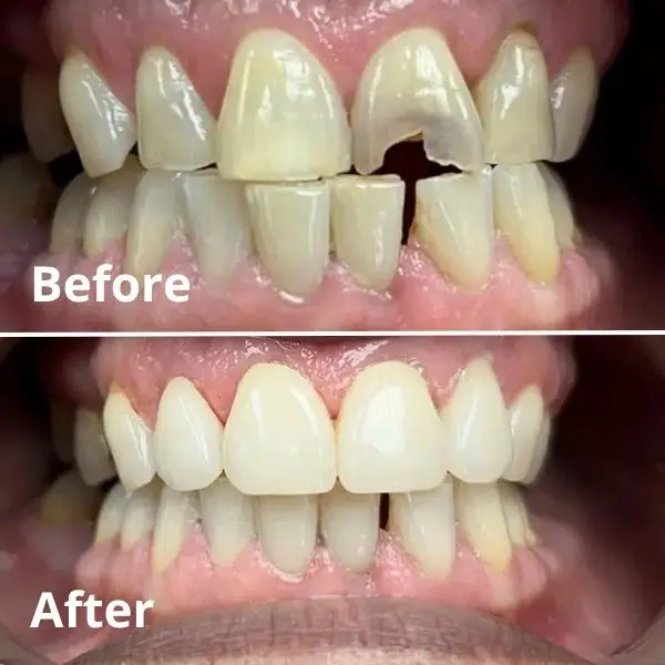 Modern Dentistry of Jupiter | Smile Gallery