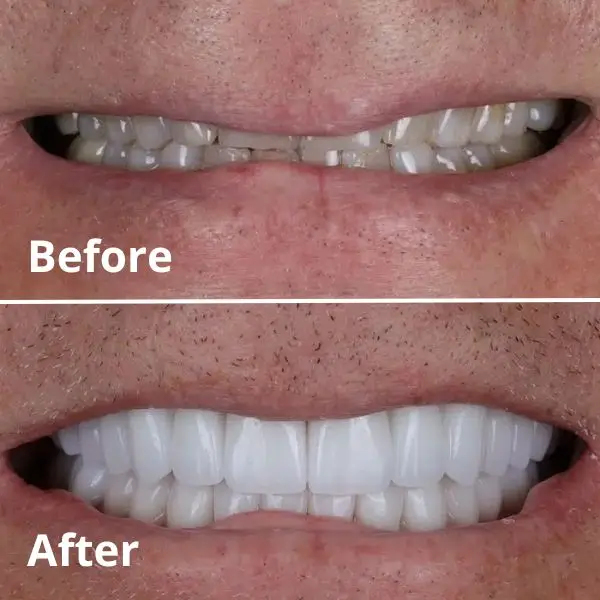 Modern Dentistry of Jupiter | Smile Gallery