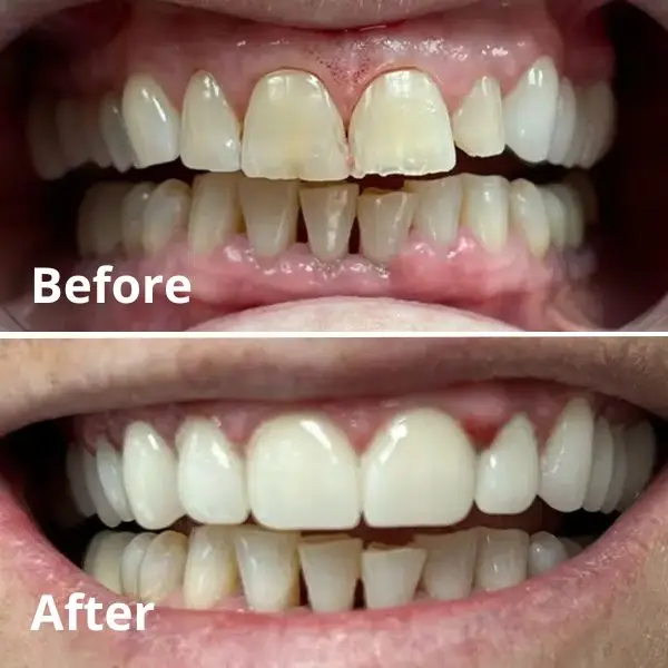 Modern Dentistry of Jupiter | Smile Gallery