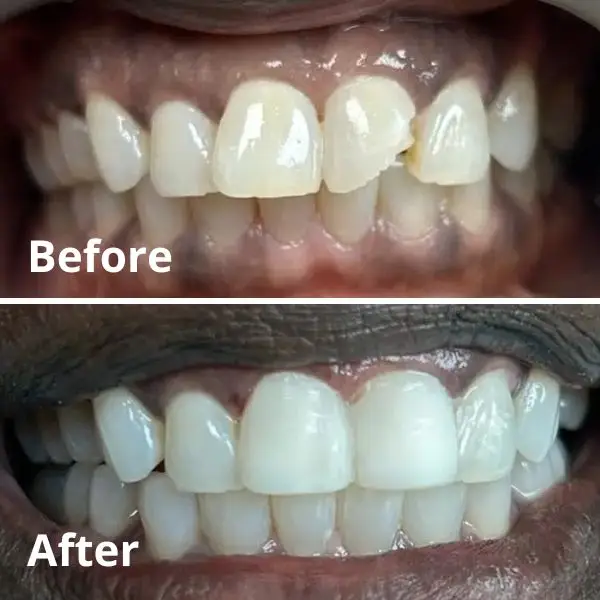 Modern Dentistry of Jupiter | Smile Gallery