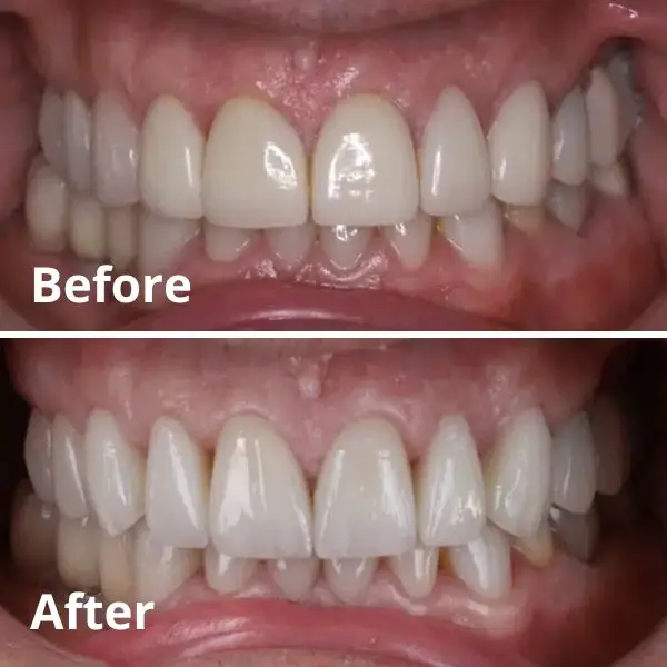 Modern Dentistry of Jupiter | Smile Gallery