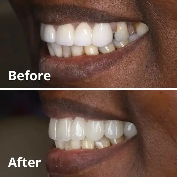 Modern Dentistry of Jupiter | Smile Gallery