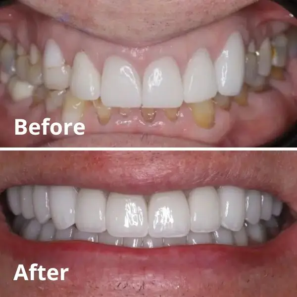 Modern Dentistry of Jupiter | Smile Gallery